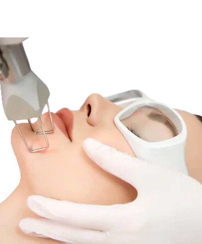 mujer-laser-co2-